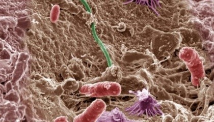 З кожним роком усе більше дослідників думає, що мікроби допоможуть нагодувати світ. З’явилося чимало подібних стартапів: AgBiome, Indigo, Maronne Bioinnovations і New Leaf Symbiotics.
