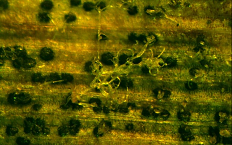 Рис. 5. Вихід спороношення Septoria tritici з пікнід