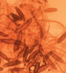 а)   а – Bipolaris sorokiniana, б – Alternaria spp., в — Fusarium spp.