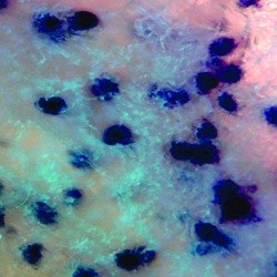 Стебло сої з ознаками мікросклероції в тканинах соняшника 