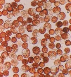 Теліоспори Ustilago tritici (фото під мікроскопом)