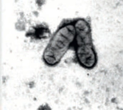 Рис. 1. Бульбочкові бактерії сої під електронним мікроскопом (ліворуч) та бульбочки на коренях рослин сої (праворуч)