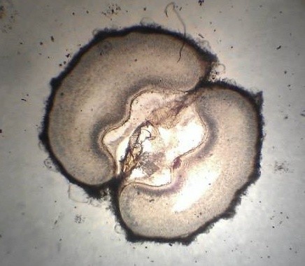 Насінина анісу під мікроскопом