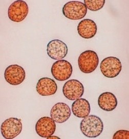 Теліоспори Tilletia caries (фото під мікроскопом)